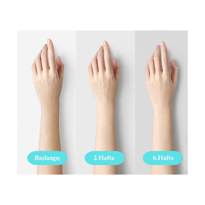 Yui IPLV15 Pro Vücut -Yüz- Bikini Başlıklı Ağrısız Otomatik ve Manuel Atım Buz Lazer Epilasyon Cihazı - Görsel 3