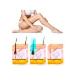 Yui IPLV15 Pro Vücut -Yüz- Bikini Başlıklı Ağrısız Otomatik ve Manuel Atım Buz Lazer Epilasyon Cihazı - Görsel 4