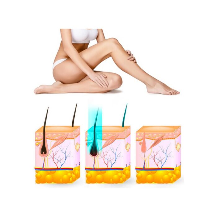 Yui IPLV15 Pro Vücut -Yüz- Bikini Başlıklı Ağrısız Otomatik ve Manuel Atım Buz Lazer Epilasyon Cihazı - Görsel 4