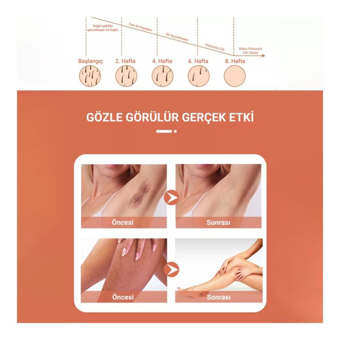 Veryfit Pb1 - 5 Kademeli Buz Lazer Özellikli 999.900 Atımlı Tüm Vücut Kullanıma Uygun Ipl - Epilasyon Cihazı - Görsel 5