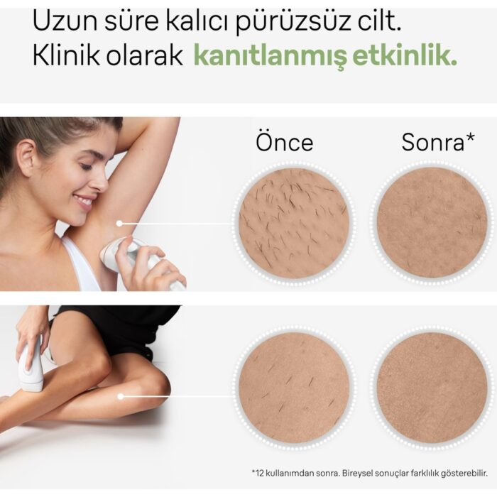 Braun Ipl Silk·expert Pro 3, Evde Tüy Alma, Çanta, Venus Tıraş Makinesi, 2 Başlık Ile, PL3132 - Görsel 4