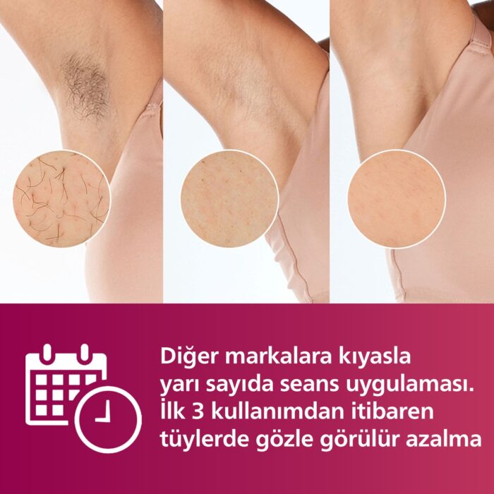 Philips BRI940/00 Lumea 450.000 ATIM Lazer Epilasyon IPL Tüy Alma Cihazı,ÇantaHEDİYELİ,Ekstra Uzun Kablo - Görsel 4