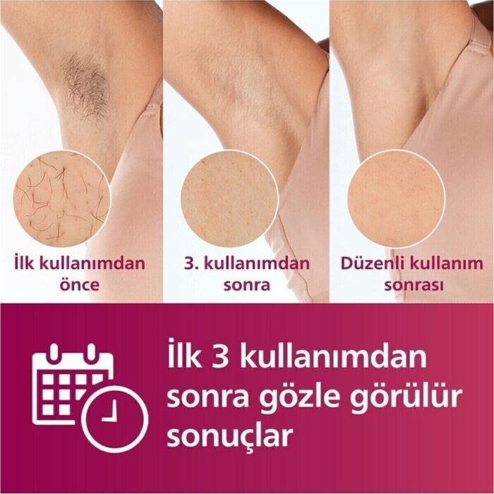 Philips Ipl Lazer Epilasyon Cihazı, 2 Akıllı Başlık (Vücut ve Yüz Başlığı), Cilt Tonu Sensörü, Compact Kalem Düzeltici, Uzun Ömürlü Kullanım+ Lambader (Onerous) - Görsel 5