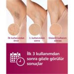 Philips Lumea Ipl Tüy Alma Cihazı, Çantalı, Yüz Temizleme Cihazı Hediyeli + Tıraş Makinesi + Tüy Alma Cihazı, Yüz/vücut/hassas Bölge Kullanımı, Cilt Tonu Sensörü ile Güvenli Epilasyon + Lambader (Onerous) - Görsel 3