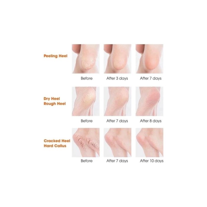 AyrStore Silikon Topuk Nemlendirici Çorap - Görsel 2